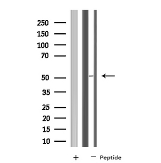 IOP1 / NARFL Antibody - Western blot analysis of extracts of A549 cells using NARFL antibody.