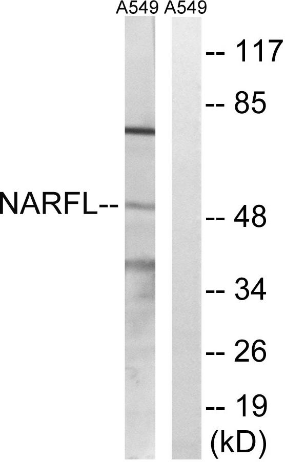 IOP1 / NARFL Antibody - Western blot analysis of extracts from A549 cells, using NARFL antibody.