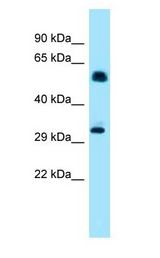 IP6K1 Antibody - IP6K1 antibody Western Blot of Mouse Heart.  This image was taken for the unconjugated form of this product. Other forms have not been tested.