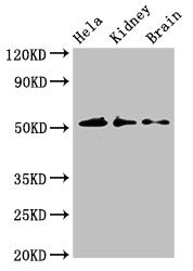 IP6K1 Antibody - Western Blot Positive WB detected in:Hela whole cell lysate,Mouse kidney tissue,Mouse brain tissue All Lanes:IP6K1 antibody at 3.5µg/ml Secondary Goat polyclonal to rabbit IgG at 1/50000 dilution Predicted band size: 51,32 KDa Observed band size: 51 KDa
