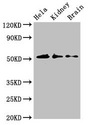IP6K1 Antibody - Western Blot Positive WB detected in:Hela whole cell lysate,Mouse kidney tissue,Mouse brain tissue All Lanes:IP6K1 antibody at 3.5µg/ml Secondary Goat polyclonal to rabbit IgG at 1/50000 dilution Predicted band size: 51,32 KDa Observed band size: 51 KDa