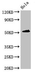 IP6K1 Antibody - Western Blot Positive WB detected in: Hela whole cell lysate All lanes: IP6K1 antibody at 3.5µg/ml Secondary Goat polyclonal to rabbit IgG at 1/50000 dilution Predicted band size: 51, 32 kDa Observed band size: 51 kDa