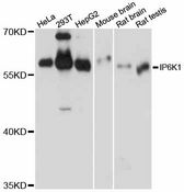 IP6K1 Antibody - Western blot analysis of extracts of various cell lines, using IP6K1 antibody at 1:1000 dilution. The secondary antibody used was an HRP Goat Anti-Rabbit IgG (H+L) at 1:10000 dilution. Lysates were loaded 25ug per lane and 3% nonfat dry milk in TBST was used for blocking. An ECL Kit was used for detection and the exposure time was 10s.