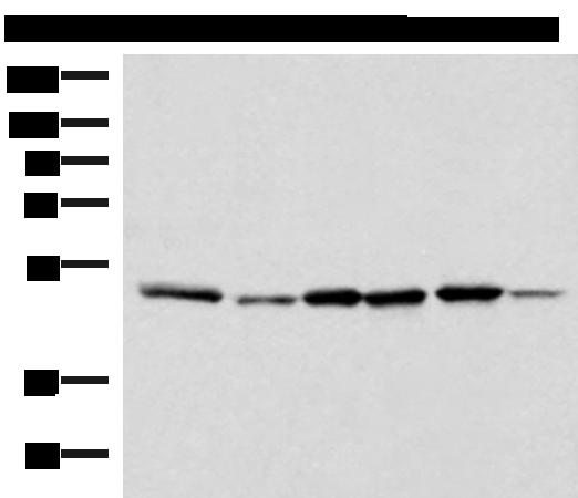 IP6K1 Antibody - Western blot analysis of Jurkat PC-3 HepG2 Hela HT-29 and Raji cell lysates  using IP6K1 Polyclonal Antibody at dilution of 1:400
