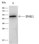 IP6K1 Antibody - IP6K1 was immunoprecipitated using: Lane A: 0.5 mg A431 Whole Cell Lysate. 4 uL anti-IP6K1 rabbit polyclonal antibody and 60 ug of Immunomagnetic beads Protein A/G. Primary antibody: Anti-IP6K1 rabbit polyclonal antibody, at 1:100 dilution. Secondary antibody: Clean-Blot IP Detection Reagent (HRP) at 1:1000 dilution. Developed using the ECL technique. Performed under reducing conditions. Predicted band size: 50 kDa. Observed band size: 50 kDa.