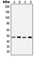 IP6K2 Antibody - Western blot analysis of IP6K2 expression in A549 (A); H1299 (B); HeLa (C); Raji (D) whole cell lysates.