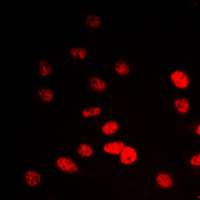 IP6K2 Antibody - Immunofluorescent analysis of IP6K2 staining in A549 cells. Formalin-fixed cells were permeabilized with 0.1% Triton X-100 in TBS for 5-10 minutes and blocked with 3% BSA-PBS for 30 minutes at room temperature. Cells were probed with the primary antibody in 3% BSA-PBS and incubated overnight at 4 C in a humidified chamber. Cells were washed with PBST and incubated with a DyLight 594-conjugated secondary antibody (red) in PBS at room temperature in the dark. DAPI was used to stain the cell nuclei (blue).