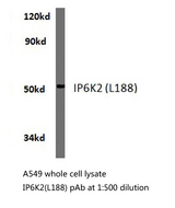 IP6K2 Antibody - Western blot of IP6K2 (L188) pAb in extracts from A549 cells.