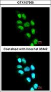 IP6K2 Antibody - Immunofluorescence of paraformaldehyde-fixed A431, using IP6K2 antibody at 1:200 dilution.