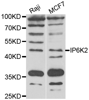 IP6K2 Antibody - Western blot analysis of extracts of various cell lines.