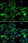 IP6K2 Antibody - Immunofluorescence analysis of A549 cells.