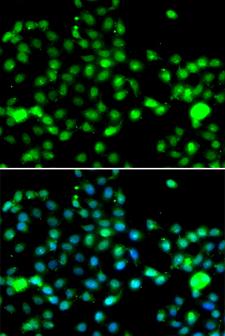 IP6K2 Antibody - Immunofluorescence analysis of A549 cells.