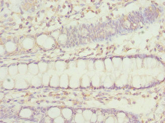 IP6K2 Antibody - Immunohistochemistry of paraffin-embedded human rectum tissue at dilution 1:100