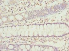 IP6K2 Antibody - Immunohistochemistry of paraffin-embedded human rectum tissue at dilution 1:100