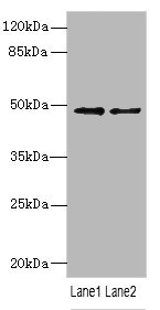 IP6K2 Antibody - Western blot All Lanes: IP6K2 antibody at 3.12ug/ml Lane 1: Mouse brain tissue Lane 2: Human Burkitt lymphoma cells Secondary Goat polyclonal to rabbit IgG at 1/10000 dilution Predicted band size: 50,12,9,21,22,10 kDa Observed band size: 49 kDa
