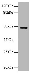 IP6K2 Antibody - Western blot All lanes: IP6K2 antibody at 3.12µg/ml + Raji whole cell lysate Secondary Goat polyclonal to rabbit IgG at 1/10000 dilution Predicted band size: 50, 12, 9, 21, 22, 10 kDa Observed band size: 50 kDa