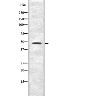 IP6K2 Antibody - Western blot analysis IP6K2 using K562 whole cells lysates