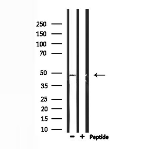 IP6K2 Antibody - Western blot analysis of extracts of mouse kidney using IP6K2 antibody.