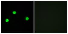 IP6K2 Antibody - Peptide - + Immunofluorescence analysis of COS-7 cells, using IP6K2 antibody.