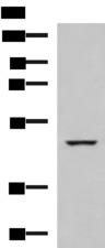 IP6K2 Antibody - Western blot analysis of K562 cell lysate  using IP6K2 Polyclonal Antibody at dilution of 1:650