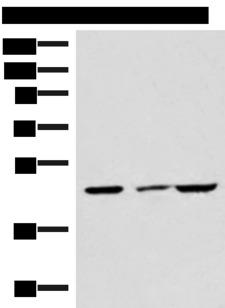 IP6K2 Antibody - Western blot analysis of HUVEC cell Mouse brain tissue and A549 cell lysates  using IP6K2 Polyclonal Antibody at dilution of 1:550