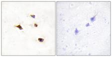 IP6K3 Antibody - Immunohistochemistry analysis of paraffin-embedded human brain tissue, using IP6K3 Antibody. The picture on the right is blocked with the synthesized peptide.