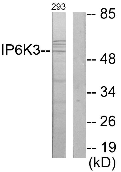 IP6K3 Antibody - Western blot analysis of lysates from 293 cells, using IP6K3 Antibody. The lane on the right is blocked with the synthesized peptide.