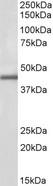 IP6K3 Antibody - Antibody (1µg/ml) staining of Human Kidney lysate (35µg protein in RIPA buffer). Primary incubation was 1 hour. Detected by chemiluminescence.