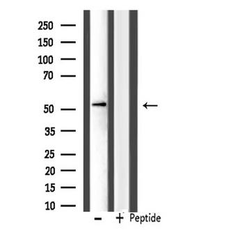 IP6K3 Antibody - Western blot analysis of extracts of 293 cells using IP6K3 antibody.