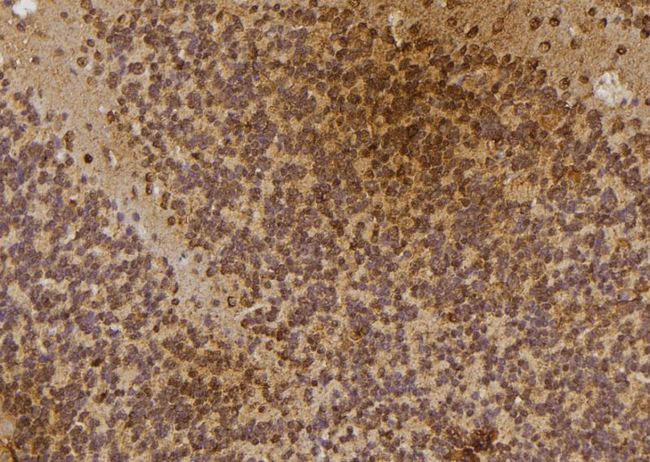 IP6K3 Antibody - 1:100 staining rat brain tissue by IHC-P. The sample was formaldehyde fixed and a heat mediated antigen retrieval step in citrate buffer was performed. The sample was then blocked and incubated with the antibody for 1.5 hours at 22°C. An HRP conjugated goat anti-rabbit antibody was used as the secondary.