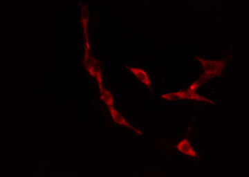 IP6K3 Antibody - Staining 293 cells by IF/ICC. The samples were fixed with PFA and permeabilized in 0.1% Triton X-100, then blocked in 10% serum for 45 min at 25°C. The primary antibody was diluted at 1:200 and incubated with the sample for 1 hour at 37°C. An Alexa Fluor 594 conjugated goat anti-rabbit IgG (H+L) antibody, diluted at 1/600, was used as secondary antibody.