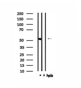 IP6K3 Antibody - Western blot analysis of extracts of mouse muscle using IP6K3 antibody.