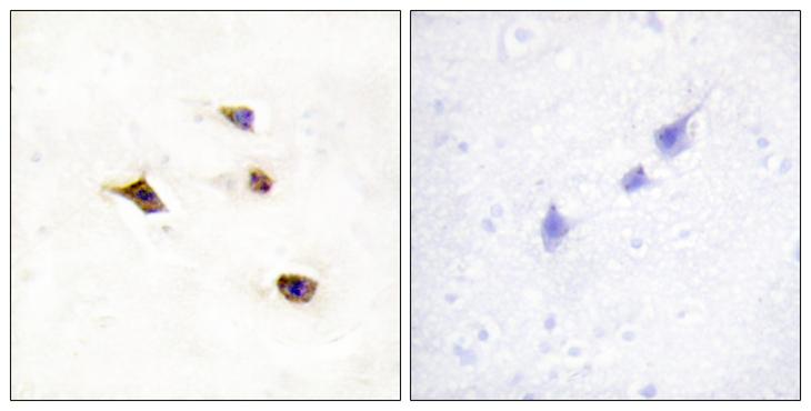 IP6K3 Antibody - Peptide - + Immunohistochemistry analysis of paraffin-embedded human brain tissue using IP6K3 antibody.