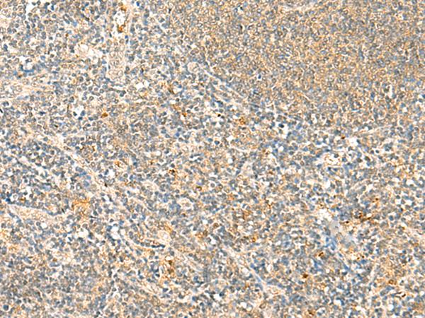 IP6K3 Antibody - Immunohistochemistry of paraffin-embedded Human tonsil tissue  using IP6K3 Polyclonal Antibody at dilution of 1:50(×200)