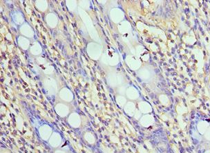 IPAF / NLRC4 Antibody - Immunohistochemistry of paraffin-embedded human rectum using antibody at 1:100 dilution.
