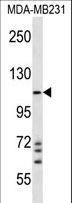 IPAF / NLRC4 Antibody - NLRC4 Antibody western blot of MDA-MB231 cell line lysates (35 ug/lane). The NLRC4 antibody detected the NLRC4 protein (arrow).