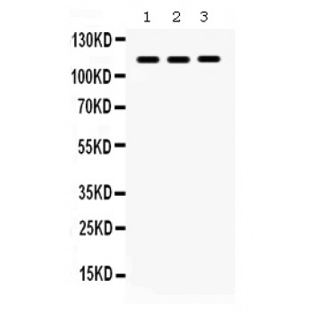IPAF / NLRC4 Antibody - CARD12 antibody Western blot. All lanes: Anti CARD12 at 0.5 ug/ml. Lane 1: 22RV1 Whole Cell Lysate at 40 ug. Lane 2: RH35 Whole Cell Lysate at 40 ug. Lane 3: NIH3T3 Whole Cell Lysate at 40 ug. Predicted band size: 116 kD. Observed band size: 116 kD.