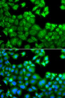 IPAF / NLRC4 Antibody - Immunofluorescence analysis of A549 cells.