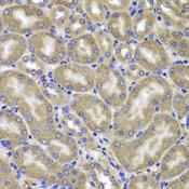 IPAF / NLRC4 Antibody - Immunohistochemistry of paraffin-embedded Mouse kidney using NLRC4 Polyclonal Antibody at dilution of 1:100 (40x lens).