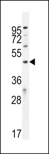 IPCEF1 / PIP3E Antibody - ICEF1 Antibody western blot of U251 cell line lysates (35 ug/lane). The ICEF1 antibody detected the ICEF1 protein (arrow).