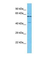 IPMK Antibody - Western blot of Human HeLa. IPMK antibody dilution 1.0 ug/ml.  This image was taken for the unconjugated form of this product. Other forms have not been tested.
