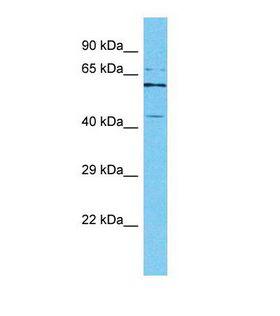 IPMK Antibody - Western blot of Human HeLa. IPMK antibody dilution 1.0 ug/ml.  This image was taken for the unconjugated form of this product. Other forms have not been tested.