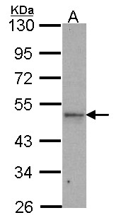 IPMK Antibody - Sample (30 ug of whole cell lysate). A: H1299. 10% SDS PAGE. IPMK antibody. IPMK antibody diluted at 1:1000.