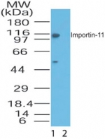 IPO11 / Importin 11 Antibody - Western blot of Importin-11inHeLa lysate in the 1) absence and 2) presence of immunizing peptide using antibody at1 ug/ml.