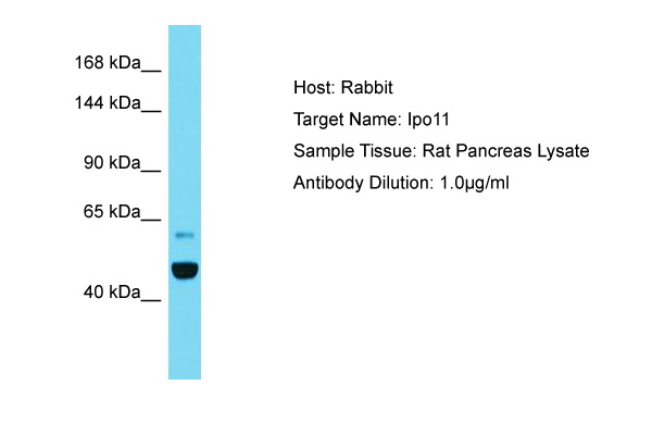 IPO11 / Importin 11 Antibody -  This image was taken for the unconjugated form of this product. Other forms have not been tested.