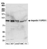 IPO11 / Importin 11 Antibody - Detection of human and mouse Importin 11/IPO11 by western blot. Samples: Whole cell lysate (50 µg) from HeLa, HEK293T, Jurkat, mouse TCMK-1, and mouse NIH 3T3 cells prepared using NETN lysis buffer. Antibody: Affinity purified rabbit anti-Importin 11/IPO11 antibody used for WB at 0.1 µg/ml. Detection: Chemiluminescence with an exposure time of 3 minutes.