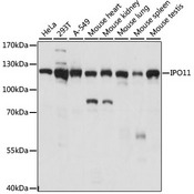 IPO11 / Importin 11 Antibody - Western blot analysis of extracts of various cell lines, using IPO11 antibody at 1:1000 dilution. The secondary antibody used was an HRP Goat Anti-Rabbit IgG (H+L) at 1:10000 dilution. Lysates were loaded 25ug per lane and 3% nonfat dry milk in TBST was used for blocking. An ECL Kit was used for detection and the exposure time was 1s.