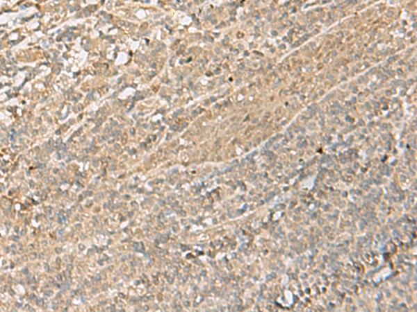 IPO11 / Importin 11 Antibody - Immunohistochemistry of paraffin-embedded Human tonsil tissue  using IPO11 Polyclonal Antibody at dilution of 1:70(×200)