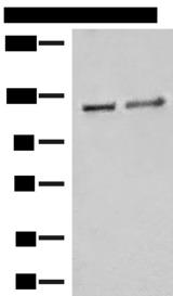 IPO11 / Importin 11 Antibody - Western blot analysis of K562 cell Human fetal brain tissue lysates  using IPO11 Polyclonal Antibody at dilution of 1:500