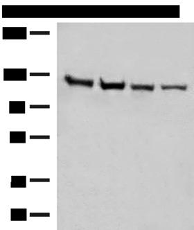 IPO11 / Importin 11 Antibody - Western blot analysis of Human fetal brain tissue K562 cell Hela and A172 cell lysates  using IPO11 Polyclonal Antibody at dilution of 1:450